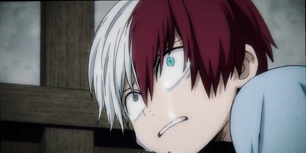 Shoto Todoroki Scar